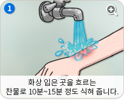 화상 입은 곳을 흐르는 찬물로 10분~15분 정도 식혀 줍니다.