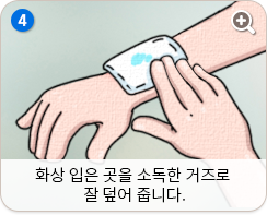 화상 입은 곳을 소독한 거즈로 잘 덮어 줍니다.