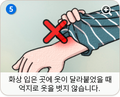 화상 입은 곳에 옷이 달라붙었을 때 억지로 옷을 벗지 않습니다.