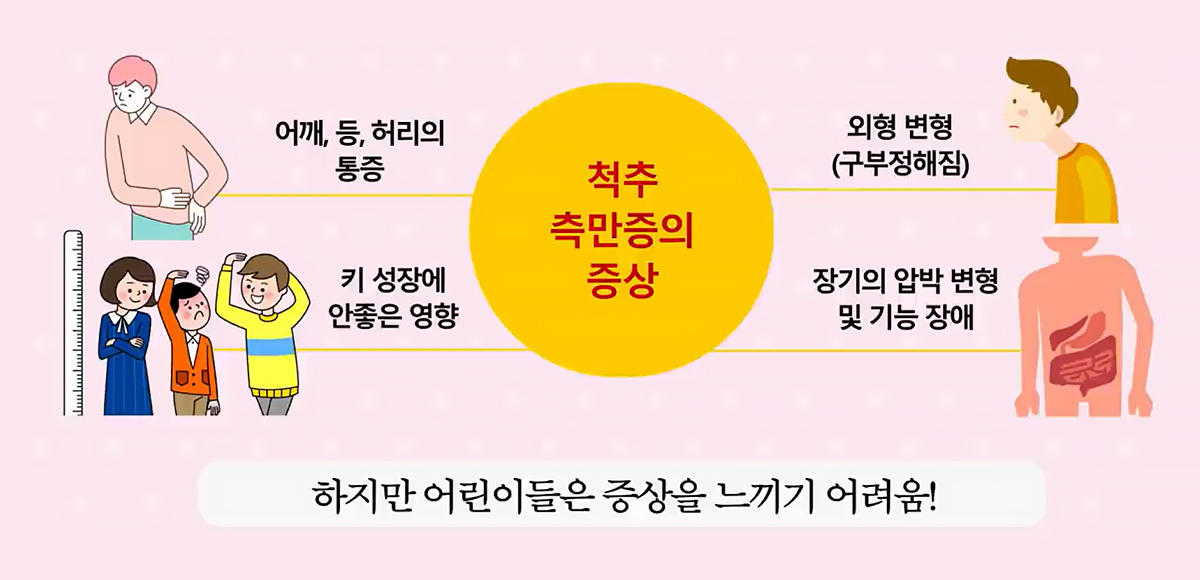 척추측만증 증상