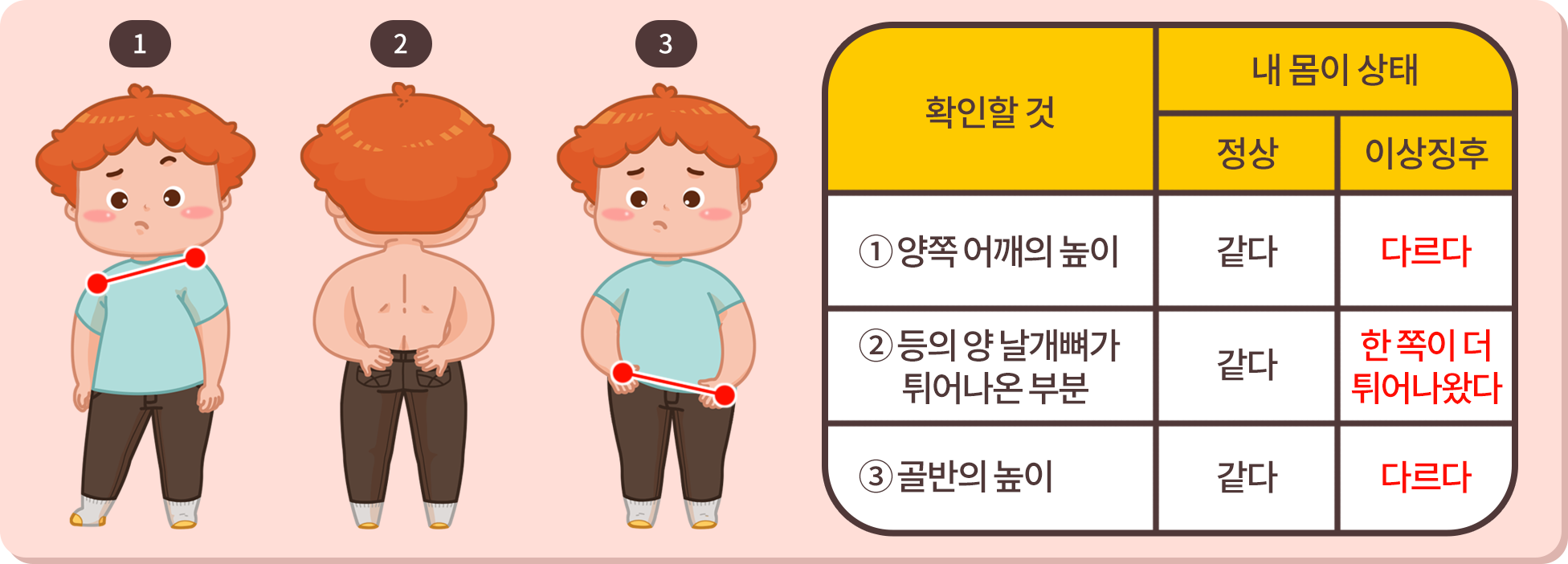 척추측만증 자가검사 방법