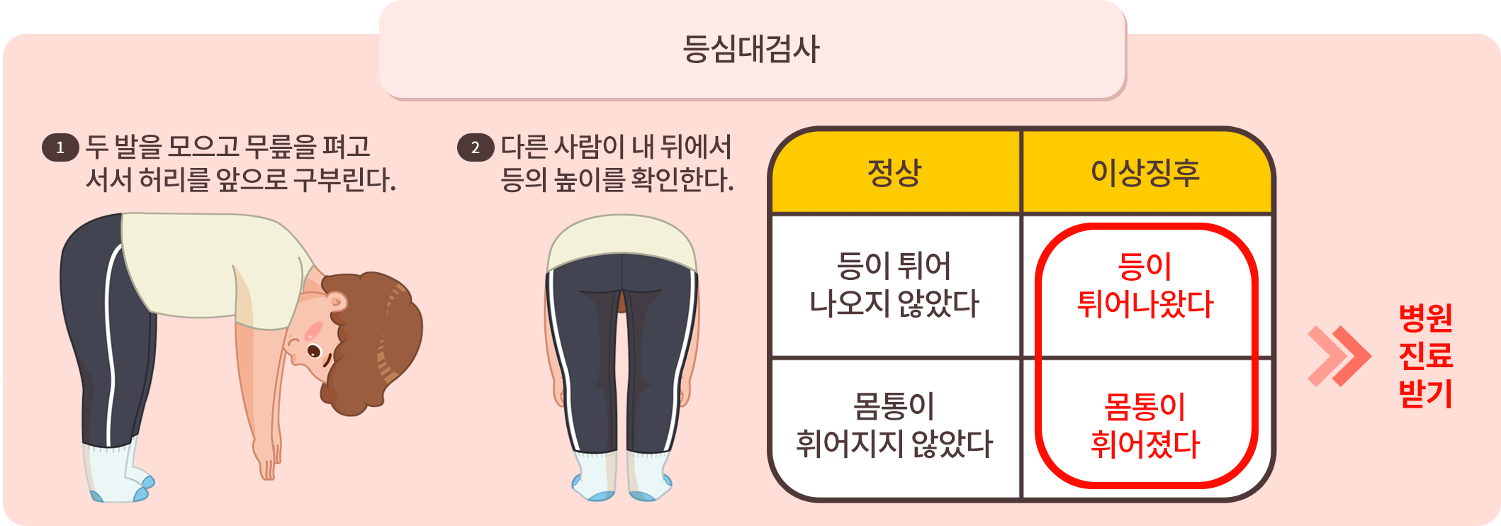등심대검사