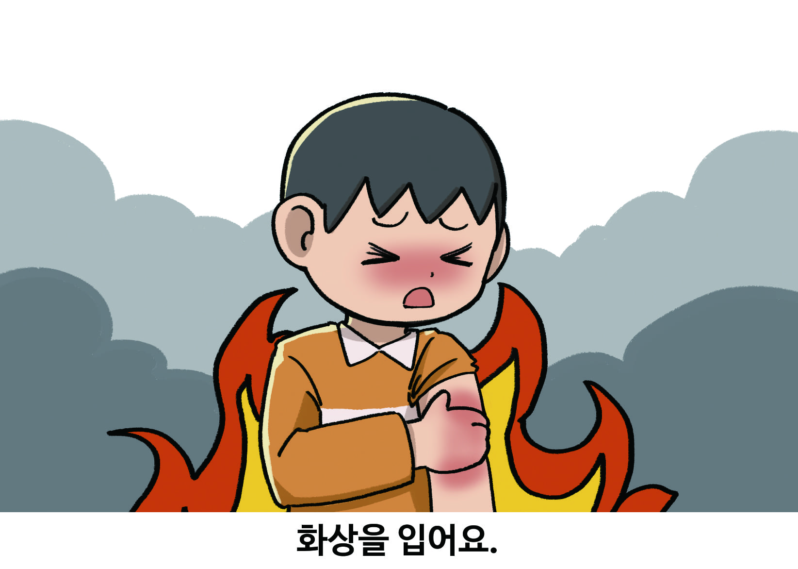 화상을 입어요.