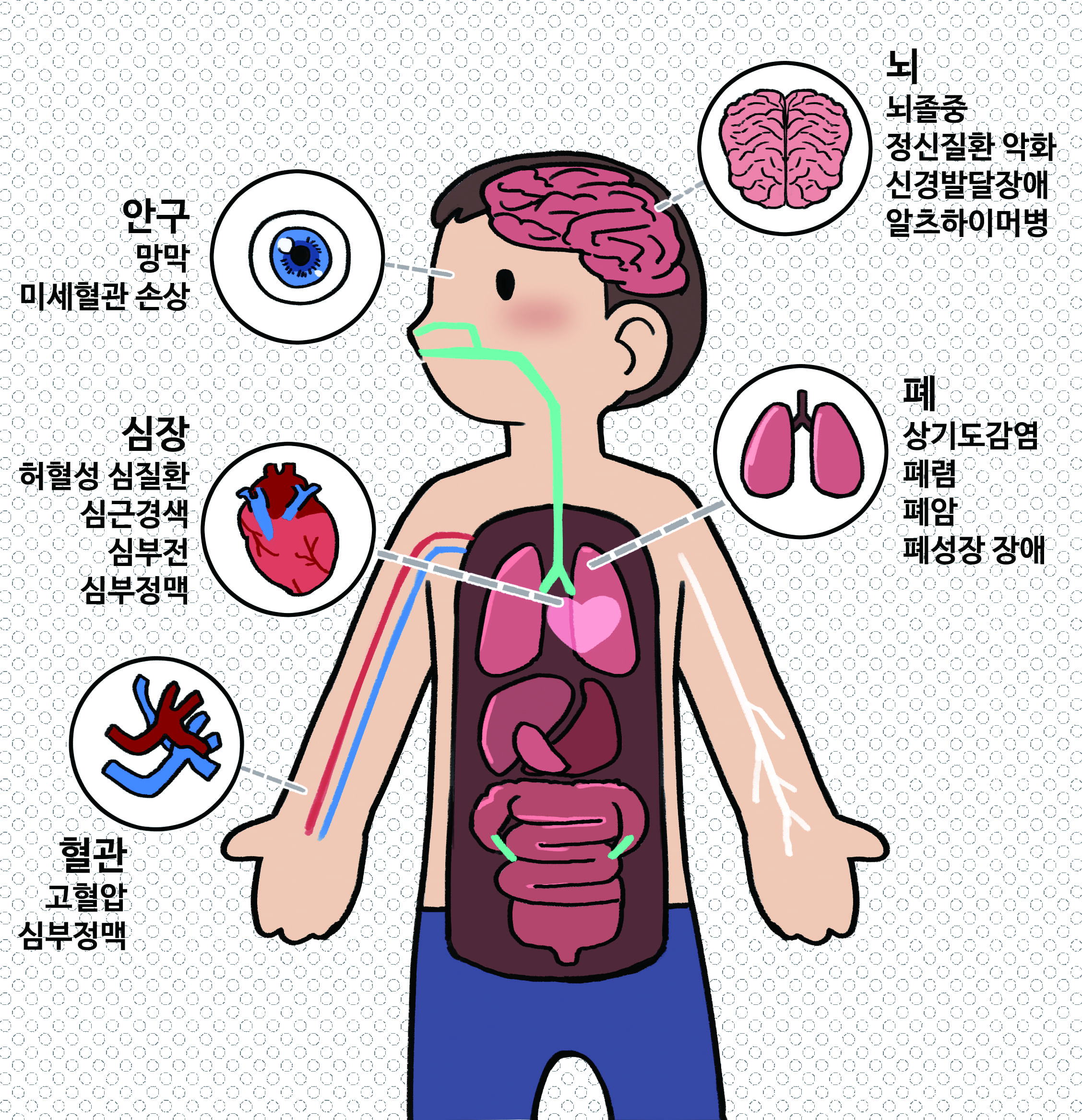 미세먼지 부작용 사진
